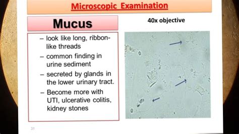 Translate mucus threads in Tagalog with examples .